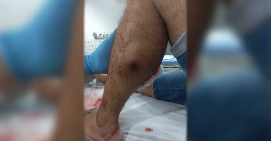Imagem de compartilhamento para o artigo Investigado por tráfico de drogas tenta tomar arma de policial e acaba baleado em Paraíso das Águas da MS Todo dia